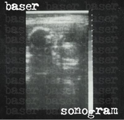 Sonogram